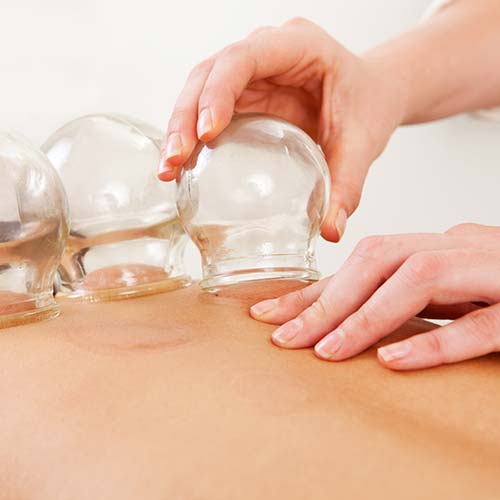 Alison Niddrie Therapy - Girl receiving cupping